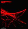 Studying the influence of nanosecond pulsed electric fields on cytoskeletal and mitochondrial networks in human glioblastoma cells with live-cell 3D structured Illumination microscopy