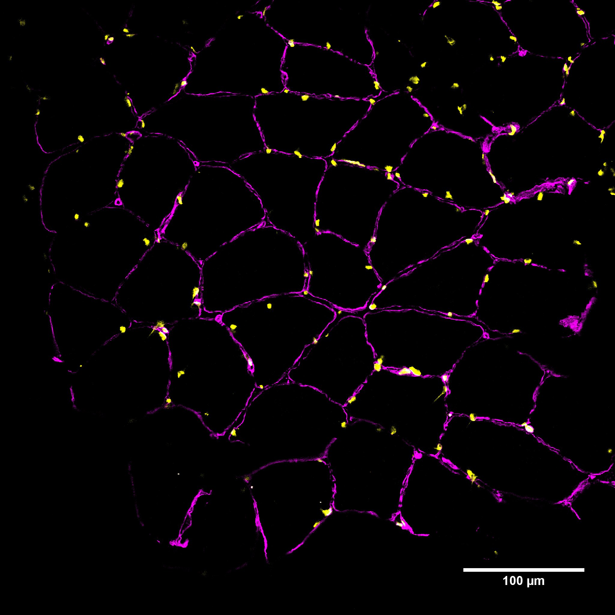 Image multiphotonique de muscle, en collaboration avec le laboratoire GAMAA (INRA)